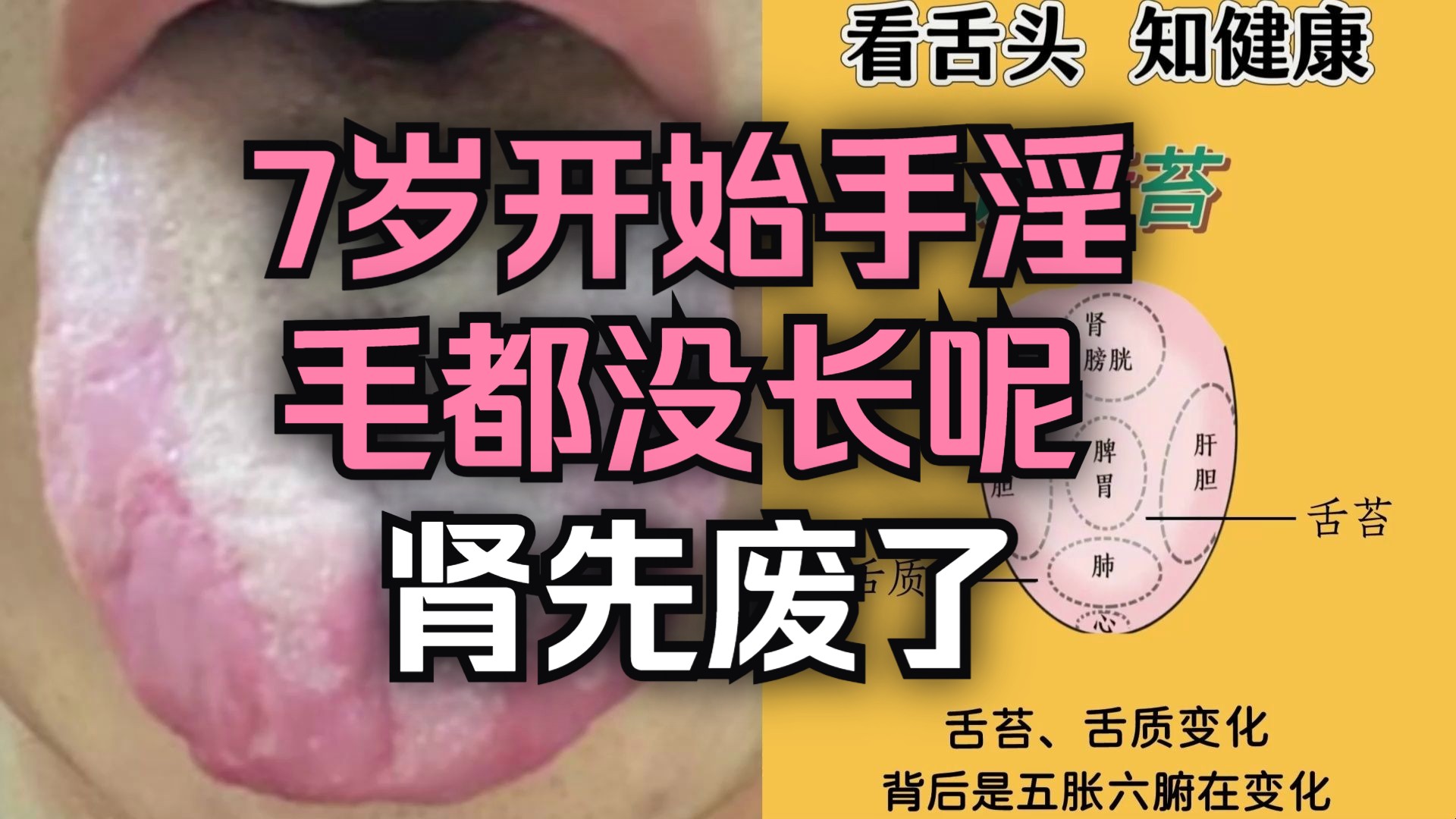 7岁开始手淫，毛都没长呢，肾先废了！