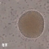 科普：显微镜下真实记录精子与卵子结合全过程（附讲解字幕）
