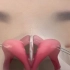 3D动画演示重度鼻头肥大矫正缩小术。