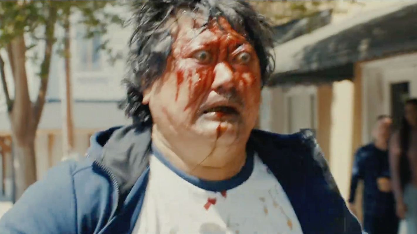 “做黄金微针呢...”