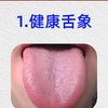 舌象分析：健康的舌象，大对比，看看你在不在其中