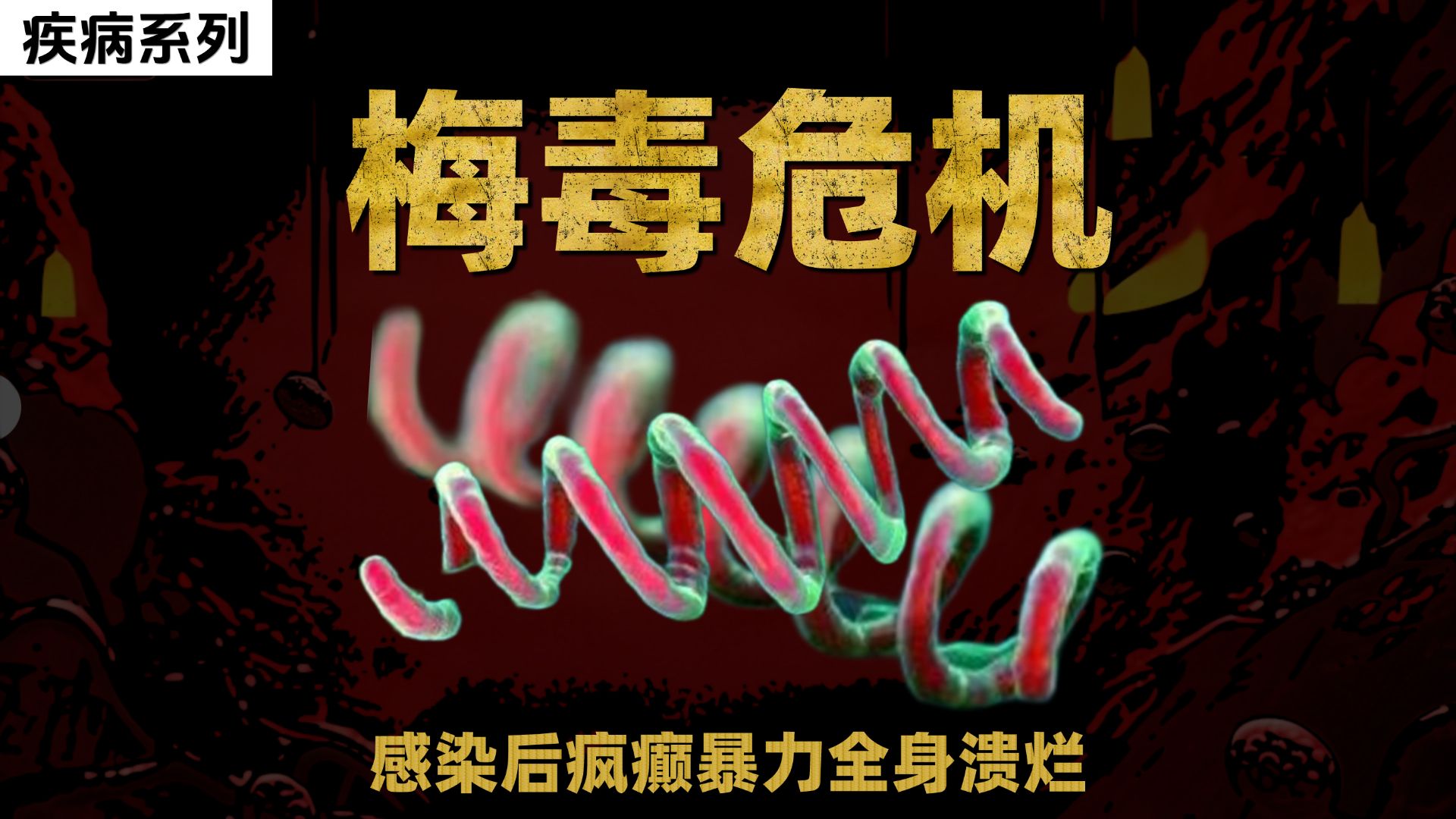 感染后疯癫暴力全身溃烂 一经感染终身标记