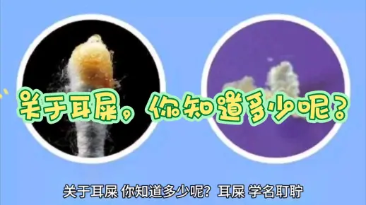 关于耳屎，你知道多少呢？