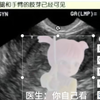 医生：她出生后会粉粉嫩嫩我：…有多粉嫩？医生：你自己看吧。我：原来是小暖暖！那没事了，可爱到燃爆地球！_游戏热门视频