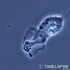 显微镜下的中性粒细胞吞噬细菌
