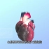 什么是“心肌梗死”？发生了应该怎么处理？