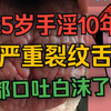 25岁小伙手淫10年，一天6-7次，都口吐白沫了