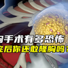 你隆过胸吗？你知道隆胸手术的过程究竟有多恐怖吗