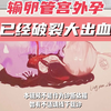 为什么肚子疼，到医院检查流程这么多？每一条规则后面都是血淋淋的教训