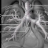 北京大学第一医院高莉-肺部基本解剖和影像学读片技巧