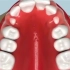 不同的牙齿 会有不同的矫正方式 ，目前比较常见的是...