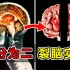 【裂脑人实验】把癫痫病人大脑切成两半，进行裂脑实验，大脑会有两个意识吗？
