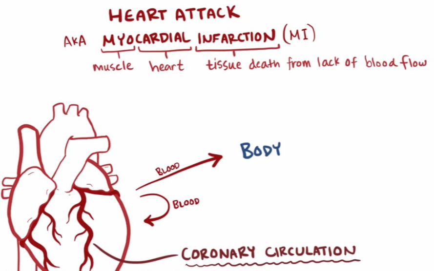 【搬运osmosis(英文 简体)】heart attack (acute myocardial