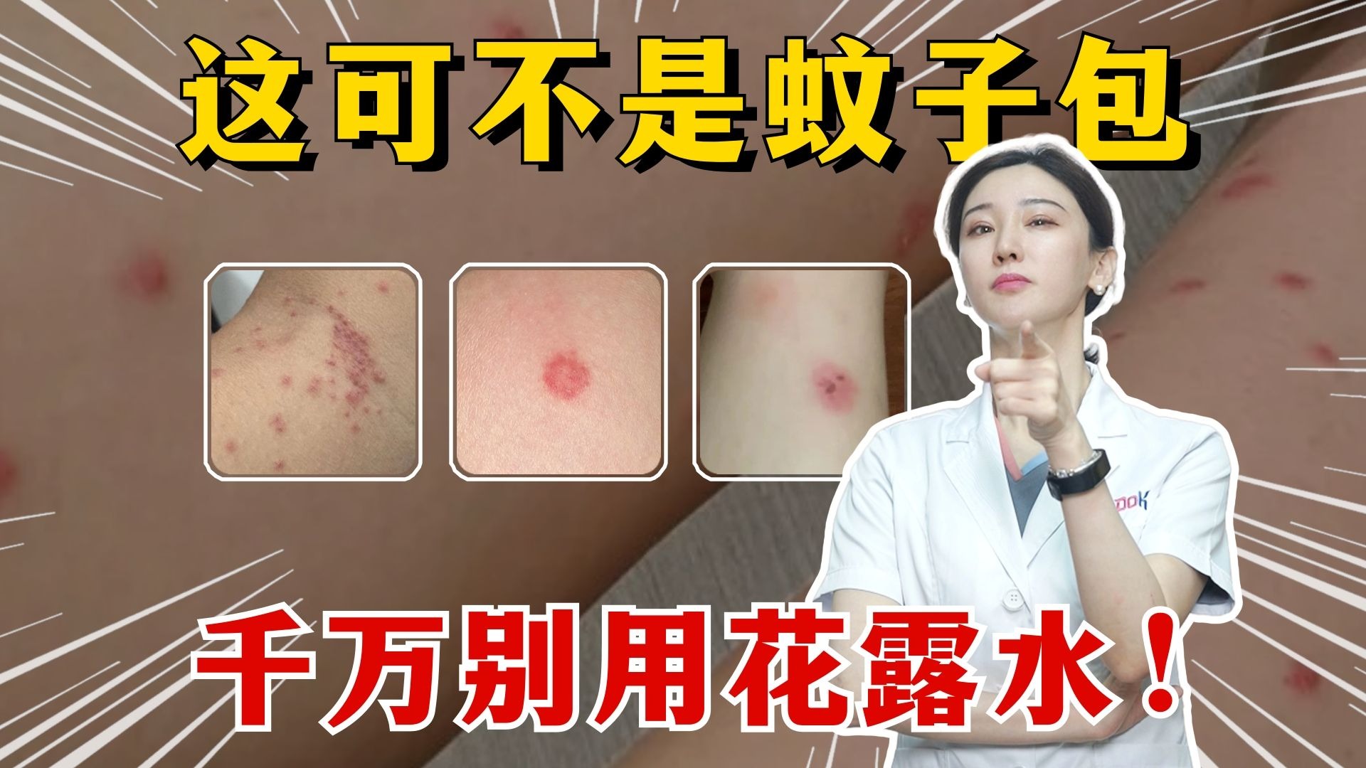 身上这些都不是蚊子包，千万别乱处理！