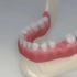 【医学3D】：种植牙的全过程，一看就懂