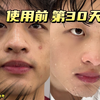 【测评】这洗面奶能当网红?痘痘多、毛孔大、油皮救星?一个月实测某宝榜一洗面奶