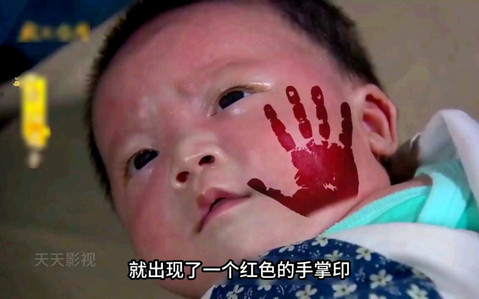 小男孩只是摸了一下婴儿的脸，不料婴儿脸上出现一个红色手掌印