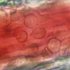 显微镜下的白细胞游出血管壁进入周围组织
