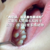 “肉切碎，连坚果也磨成粉”女童吃太精细长双排牙，医生：孩子需要多啃硬物