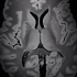 超震撼！全球最高端的7T磁共振下的人脑，100µm 的超高清图像