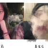 切勿模仿！一女子长期暴食催吐 后果不堪设想