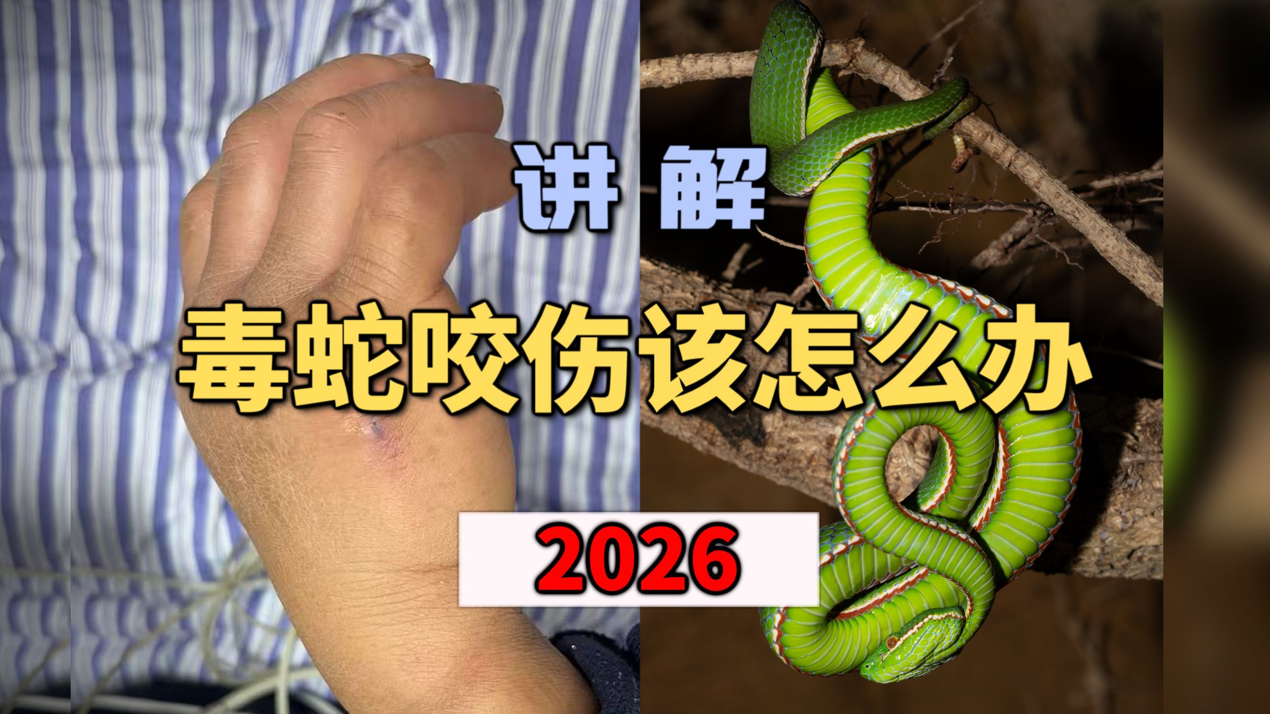 被蛇咬伤后应该怎么办？不同的毒蛇应该打什么血清?中国常见伤人毒蛇介绍！