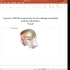Brainbee脑科学竞赛脑外伤和肿瘤 Brain Injury and Tumors神经胶质瘤中风