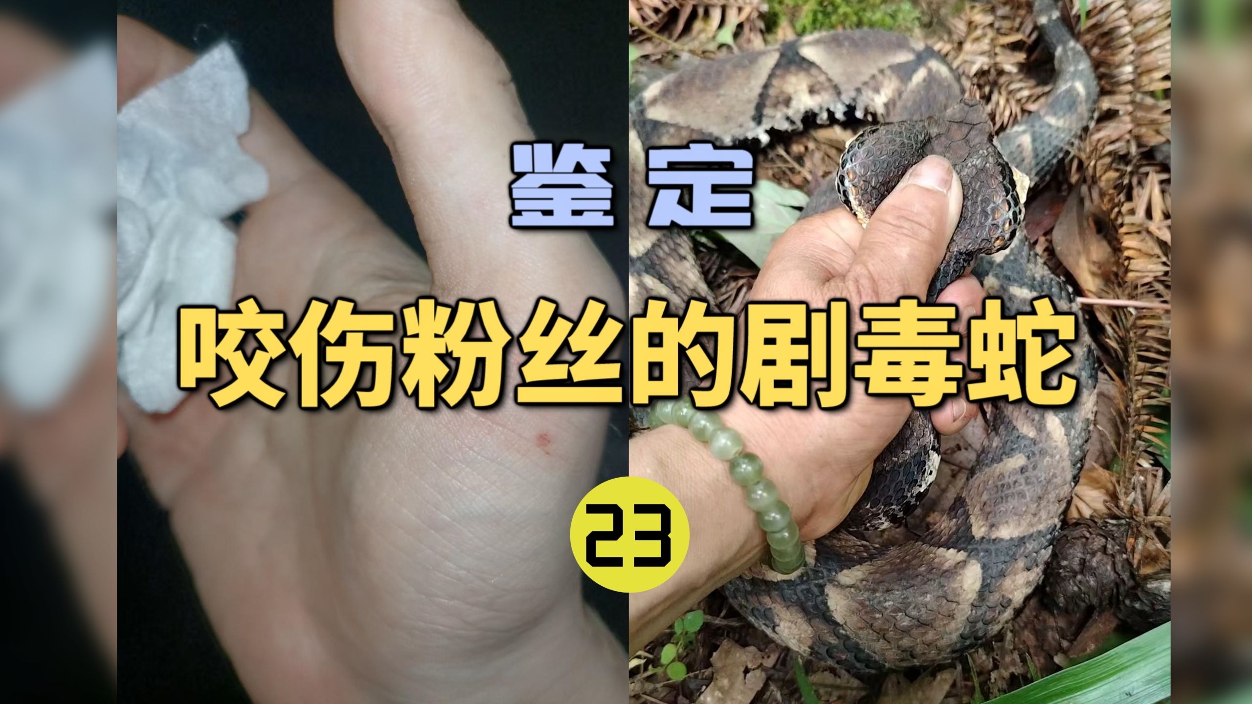 鉴定咬伤粉丝的毒蛇(23)被五步蛇咬伤竟然打了银环蛇血清？-世界记忆大师龙雅-世界记忆大师龙雅-哔哩哔哩视频