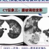 [18.1.2] 肺部CT十大征象