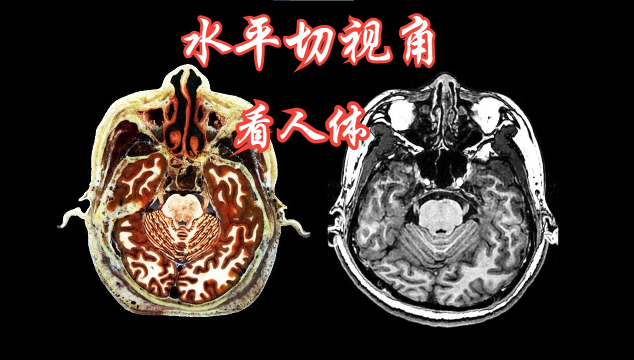 水平切视角看人体