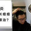 毛囊炎反复，头皮长痘痘怎么办？教你如何治疗