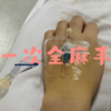 4.18全麻宫腔镜手术