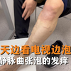 每天边看电视边泡脚把腿得快烂了
