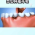 牙槽骨萎缩怎么做种植牙？植骨之后照样种植！一起看看吧 「大连齿医生口腔种植中心」「大连口腔医院」「大连种牙价格」「大连种