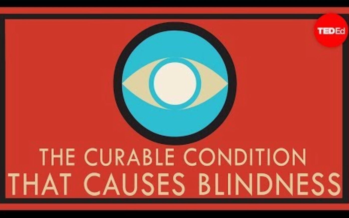 【Ted-ED】白内障：可治疗的失明 A Curable Condition That Causes Blindness