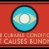 【Ted-ED】白内障：可治疗的失明 A Curable Condition That Causes Blindness