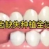 18.缺牙种植的全过程，一起看看吧！