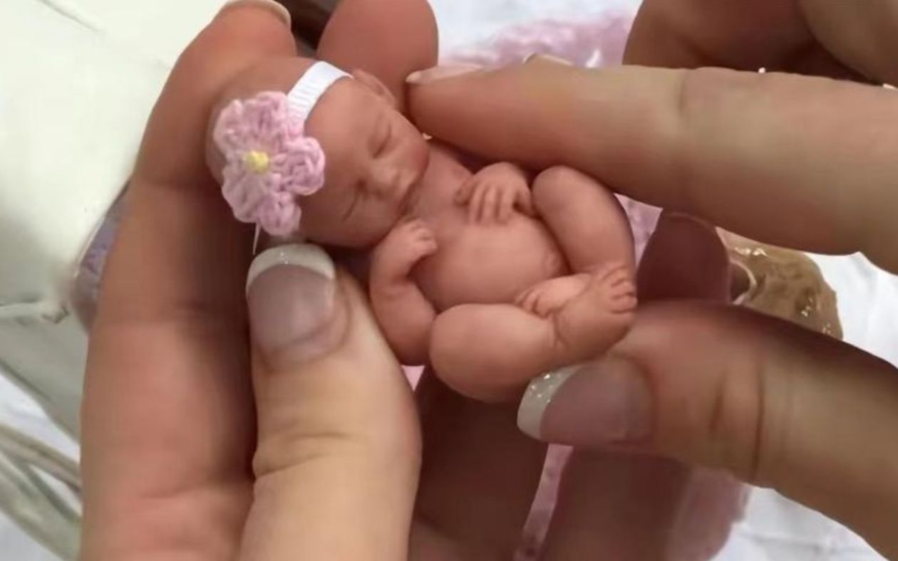 2006年，美国出现真实版拇指姑娘，出生时仅24厘米，如今怎样了？