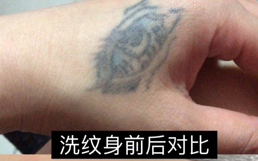 很多人纹身后悔了又怕洗不干净还留疤,看看这个虎口纹身真实效果