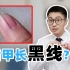 指甲长黑线，天生美甲还是癌症前兆？