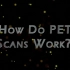 PET扫描是如何起作用的？