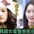12位韩国女星整容前后对比，泫雅判若两人，朴敏英堪称整容模板