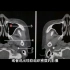 影像基础知识：副鼻窦CT解剖讲解，简单易懂，3分钟学会