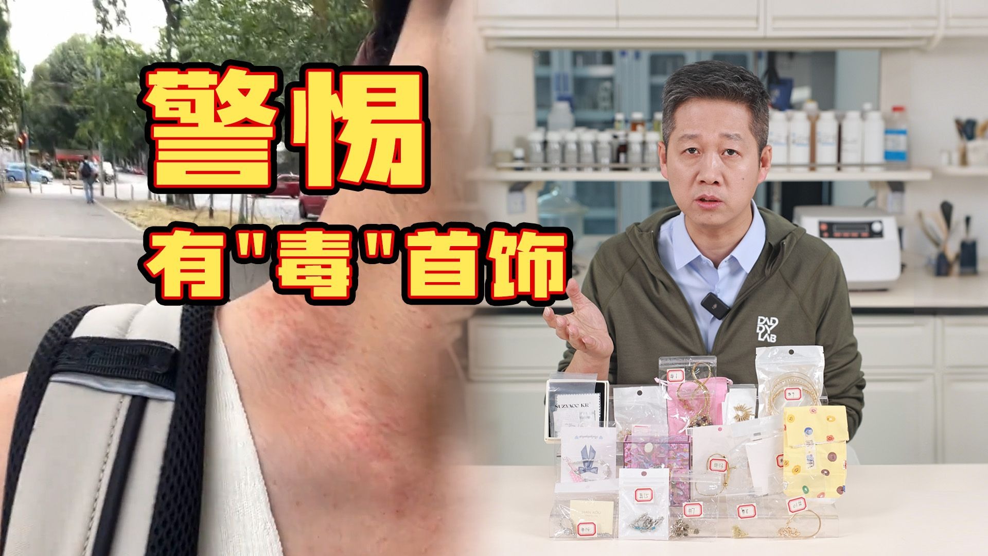 致癌物超标9000多倍！这种首饰千万别再戴了！