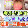 寒湿—苔白如雪，湿热—苔黄如油，痰湿一苔黏如米糊
