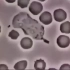 A white blood cell chasing bacteria