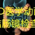 结肠镜检查-3D医学动画