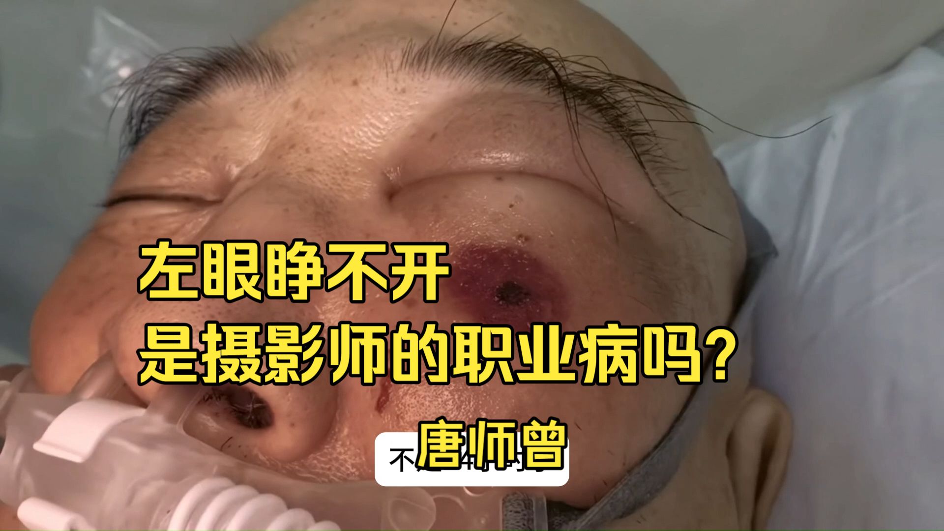 260714唐师曾：左眼睁不开，眼泪流不出 左眼睁不开，摄影师的职业病吗？
