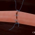 手术中神经怎么缝合，3D演示。。