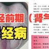 中医妇科学：月经先期（肾气虚